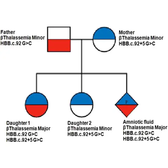 thalassemia alpha trio prenatal mutation detection